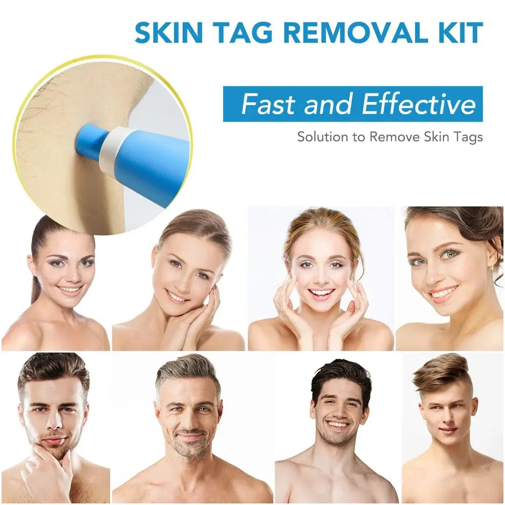 2 IN 1 Auto Micro Skin Tag Remover Device Standard And Micro Skin Tag Removal Kit Adult Mole Wart Remover Face Care Beauty Tools Diymore Global Store