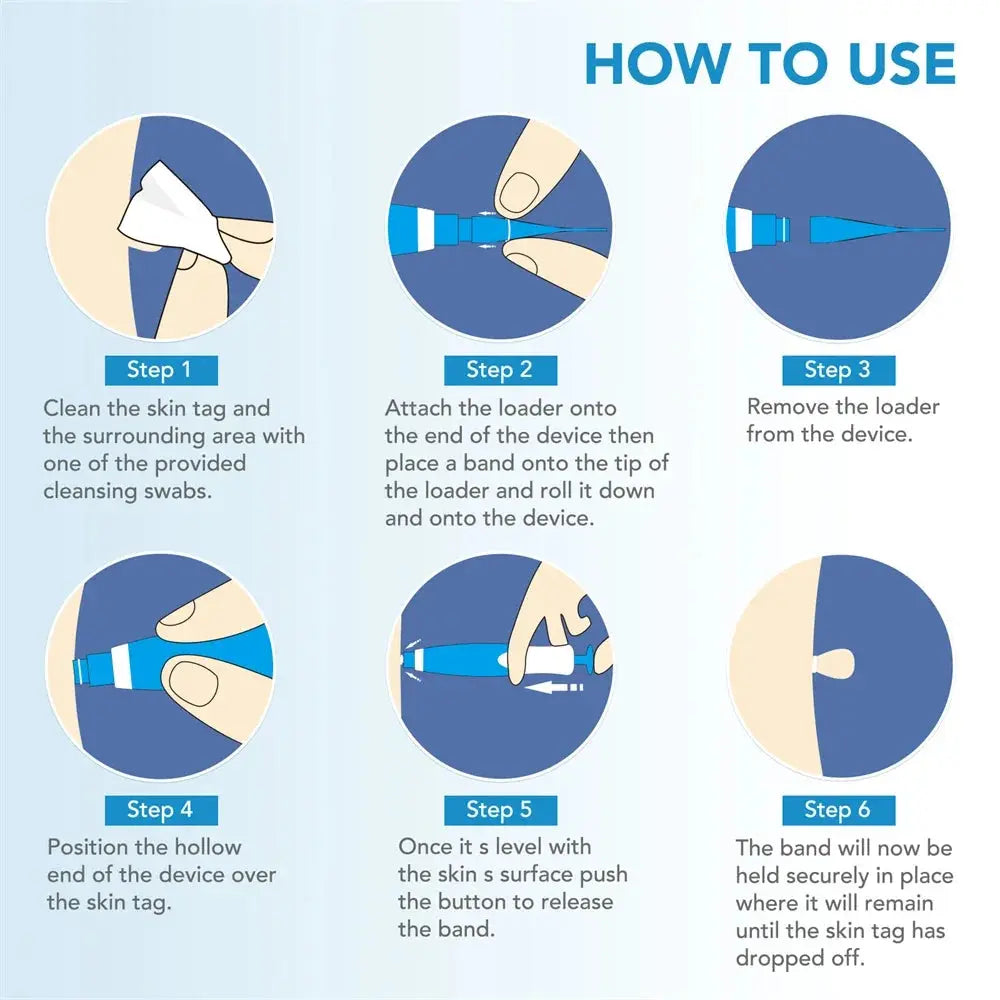 2 IN 1 Auto Micro Skin Tag Remover Device Standard And Micro Skin Tag Removal Kit Adult Mole Wart Remover Face Care Beauty Tools Diymore Global Store