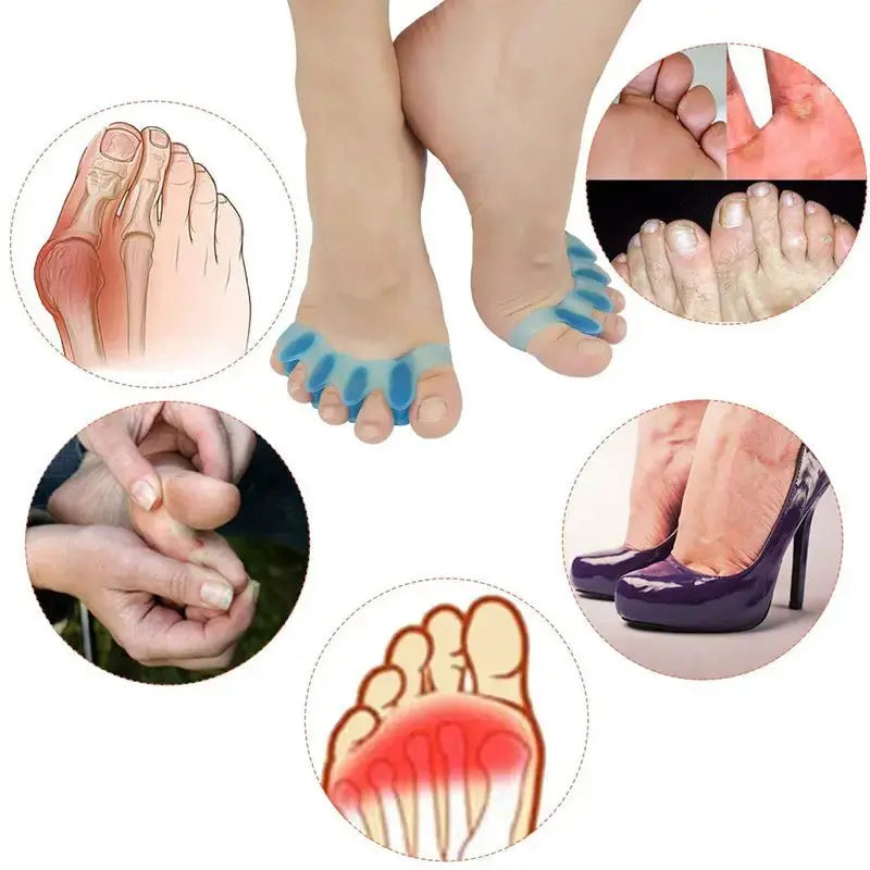 2Pcs=1Pair New Protective Toes Separator  Suitable Bunion Corrector  Material Soft Gel Straightener Spacers Stretchers Care Tool XFSKY Hair Store